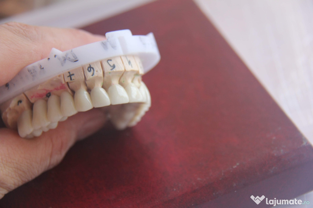 Coroană Porțelan (medicină dentară) stomatologie 150 lei