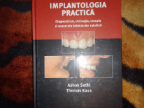 Implantologia practica - Ashok Setki , Thomas Kaus